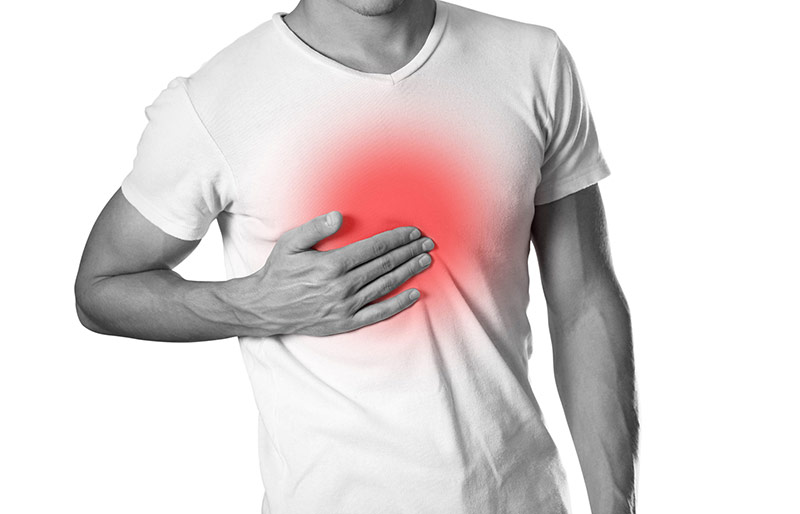 Heartburn Clinical Study