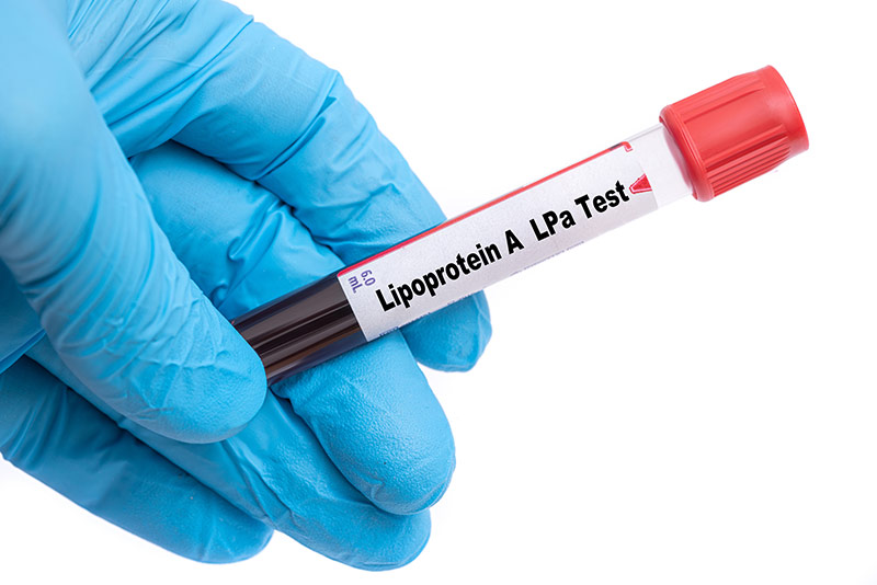 Lipoprotein Clinical Study
